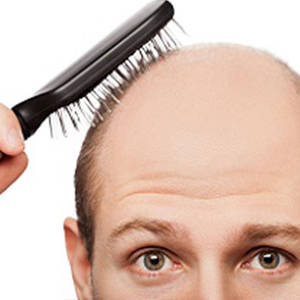 درمان خودسرانه ریزش مو ممنوع